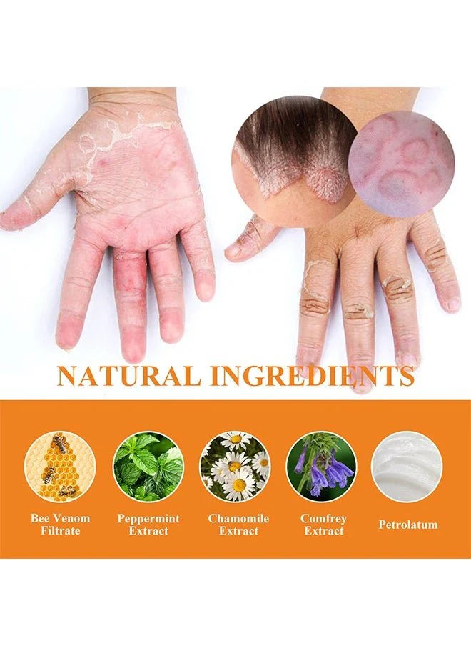 Bee Venom Psoriasis Care Cream (Original)